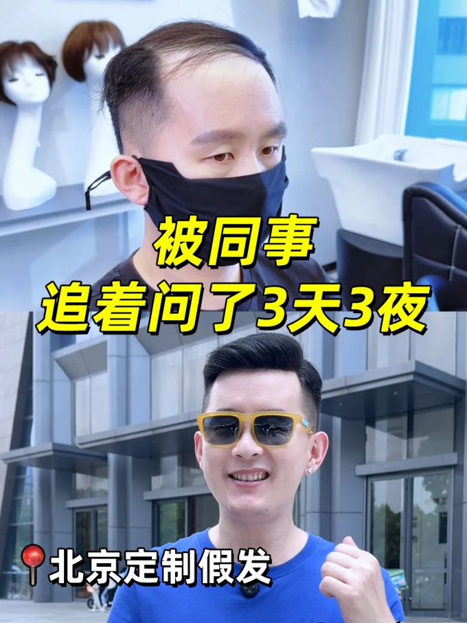 北京朝陽(yáng)定制假發(fā) \