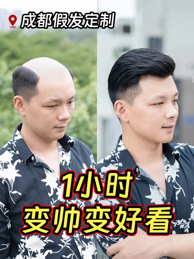 成都假發(fā)哪家好 \