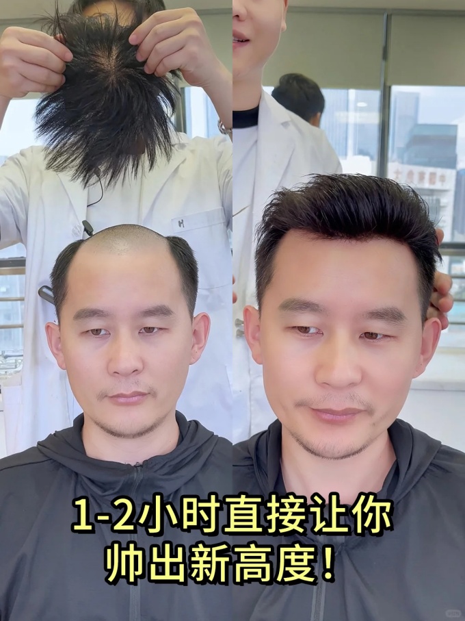 武漢假發(fā) \