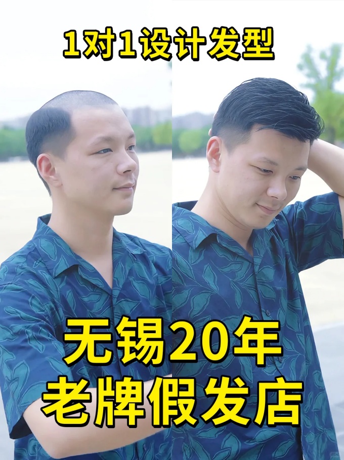 無(wú)錫假發(fā),網(wǎng)上買(mǎi)假發(fā) \