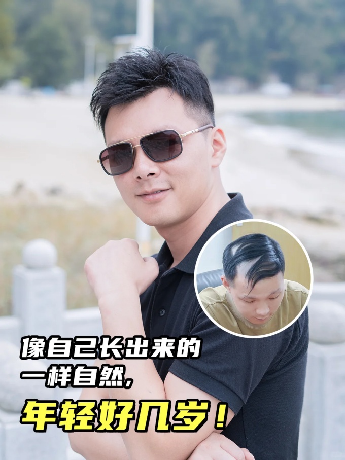 長(zhǎng)沙假發(fā)定制 \