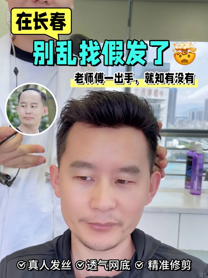 長春假發(fā),發(fā)量救星 \