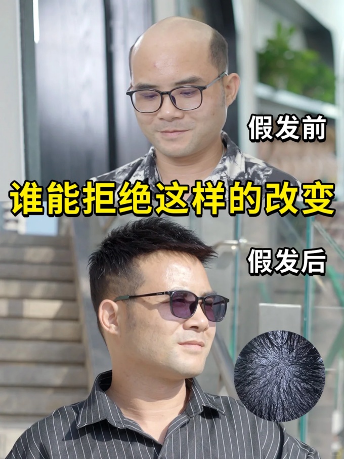 烏魯木齊定制假發(fā) \